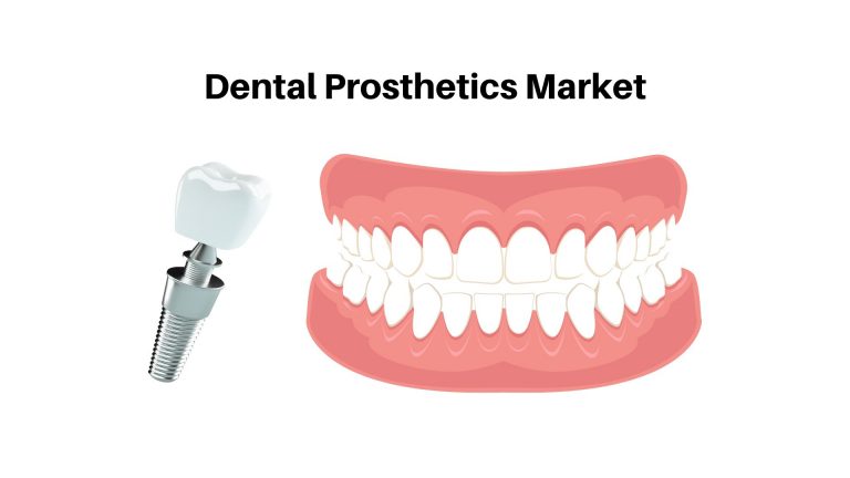 Dental Prosthetics Market