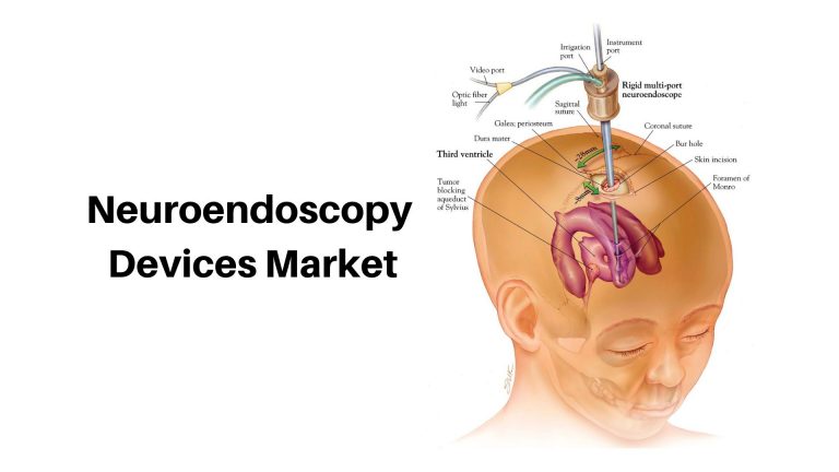 Neuroendoscopy Devices Market