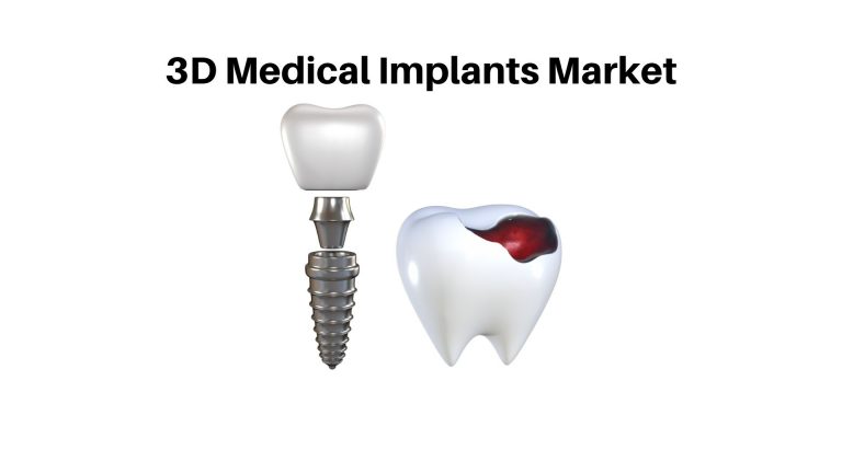 3D Medical Implants Market