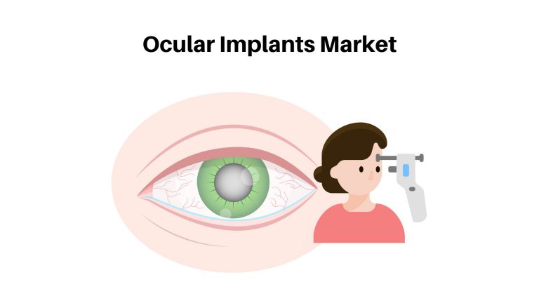 Ocular Implants Market