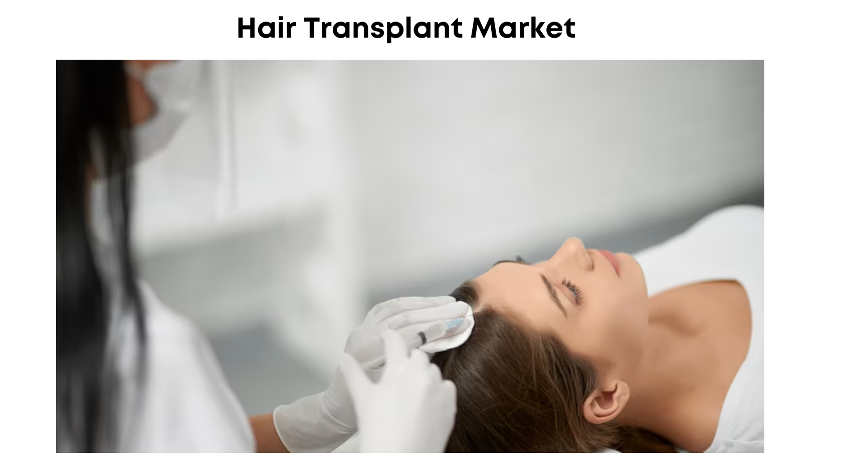 Hair Transplant Market Sales to Top USD 39 Billion in Revenues by 2032 at a CAGR of 21.8% | Market.us